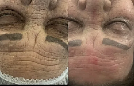 کسب و کار ساخته شده از طریق معرف