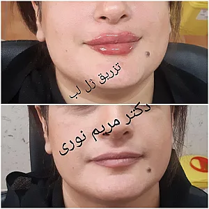 کلینیک زیبایی و لیزر دکتر مریم نوری
