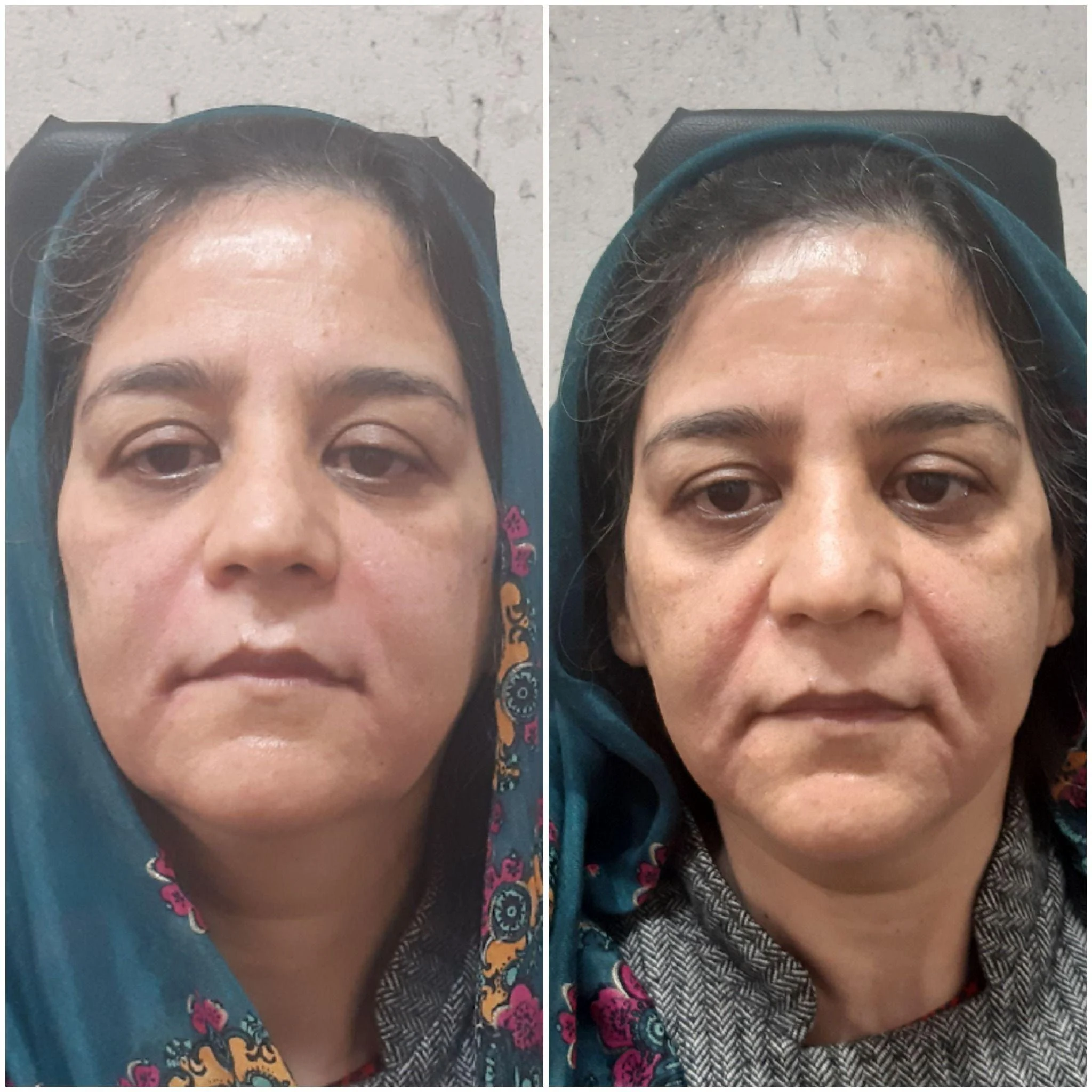 کلینیک زیبایی و لیزر دکتر مریم نوری - کلینیک پوست و زیبایی در تهران - تصویر 3