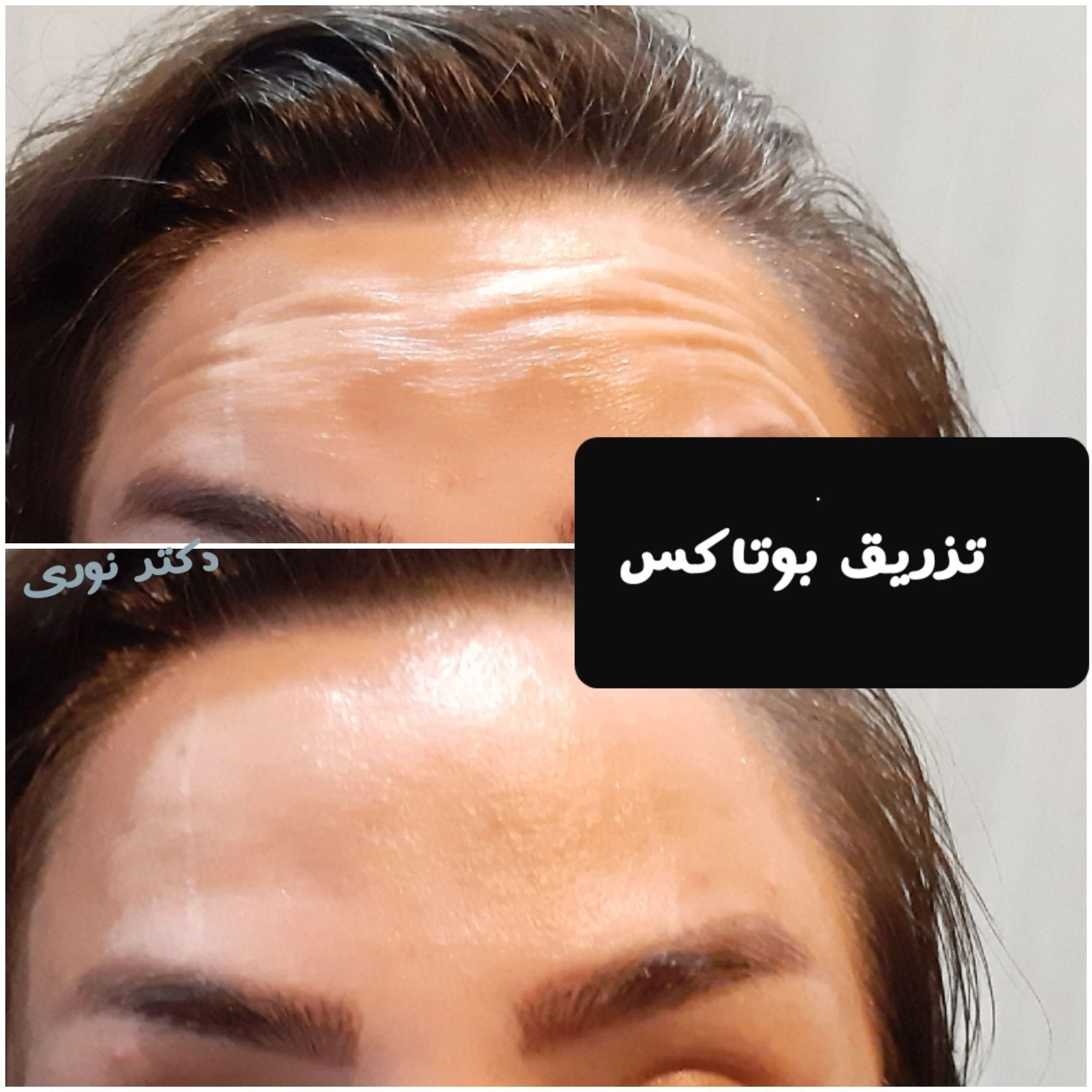 کلینیک زیبایی و لیزر دکتر مریم نوری - کلینیک پوست و زیبایی در تهران - تصویر 4