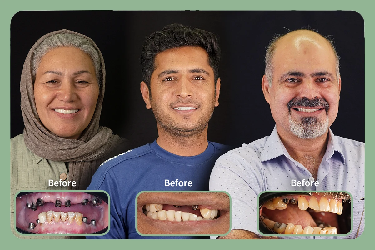 کلینیک دندانپزشکی آتیسا - تصویر 4