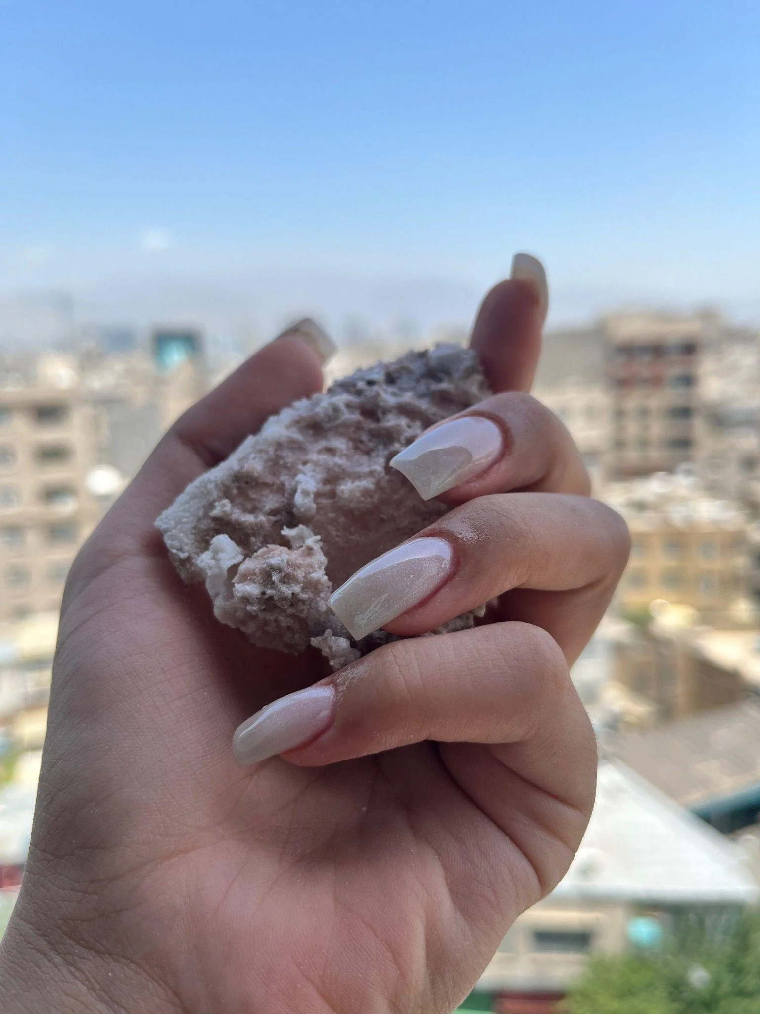انجام کلیه ناخن - تصویر 3