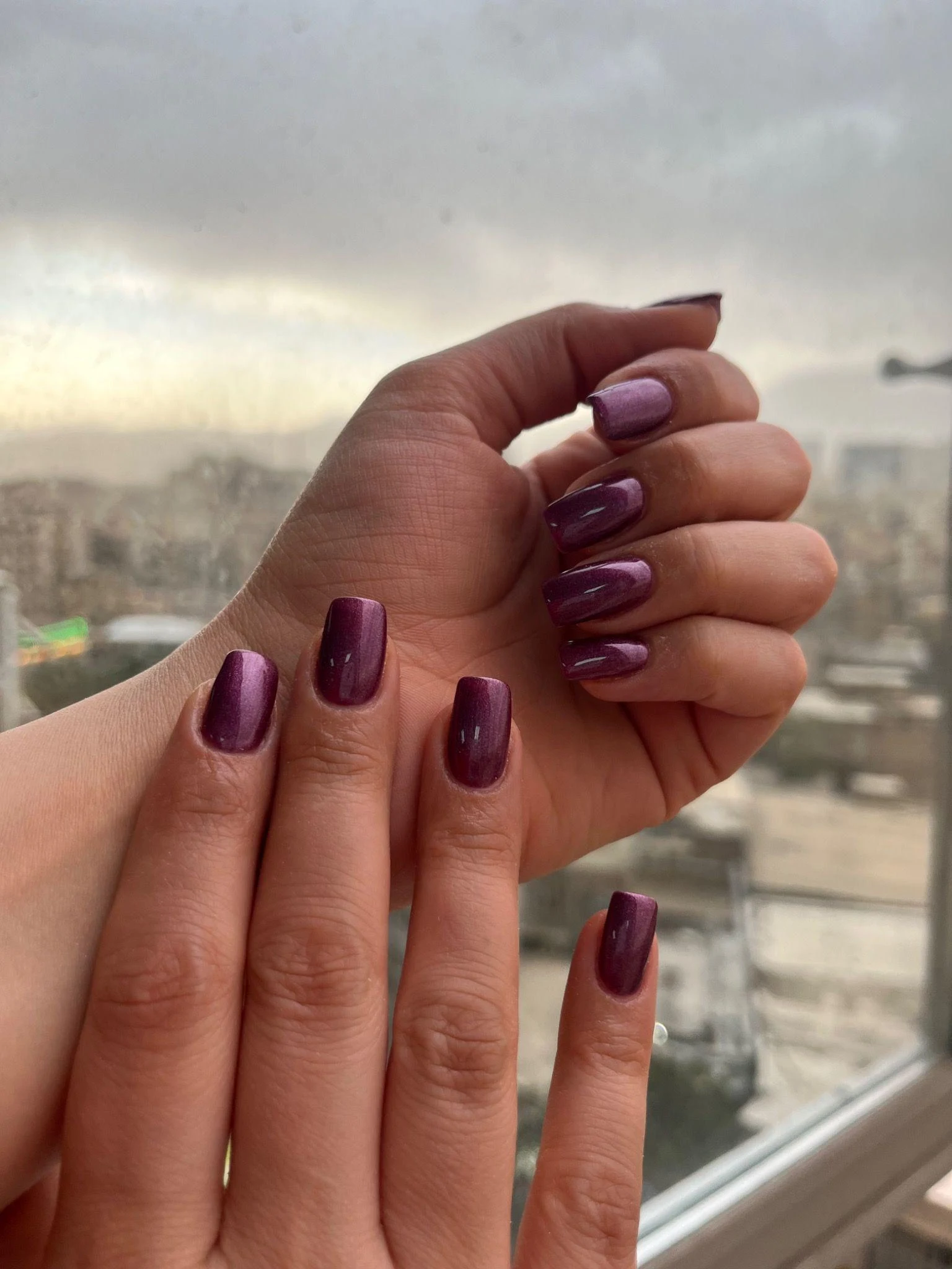 انجام کلیه ناخن - تصویر 4