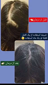 آکادمی تخصصی ترمیم مو و پوست ابراهیمی
