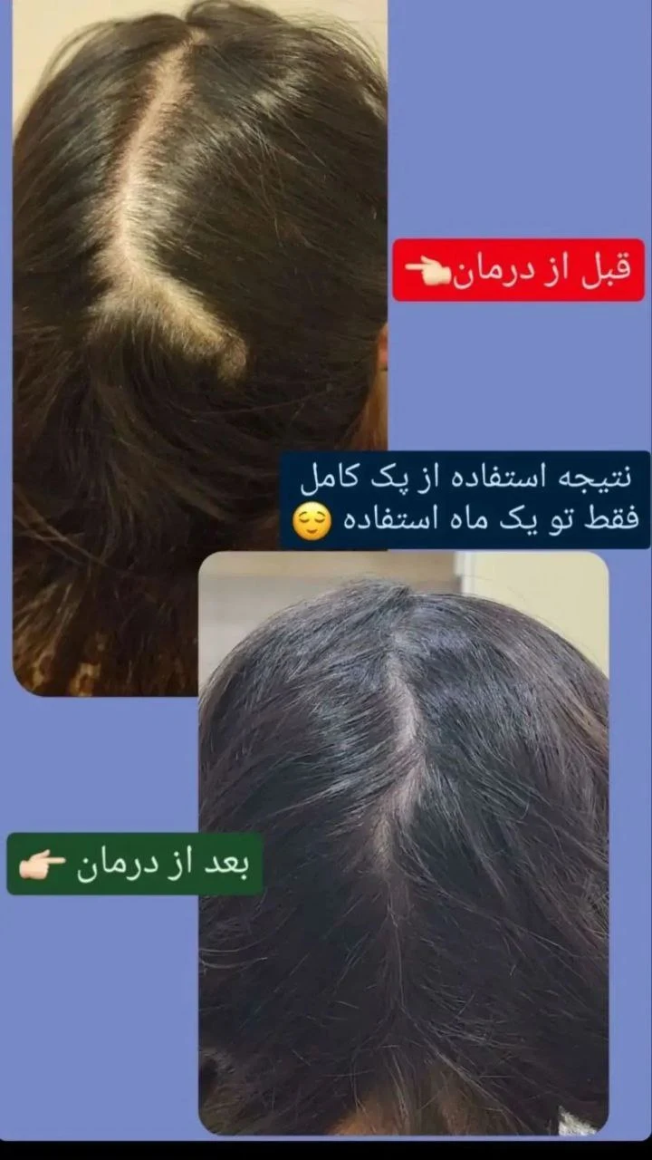 آکادمی تخصصی ترمیم مو و پوست ابراهیمی - لوازم بهداشتی و شوینده در تهران