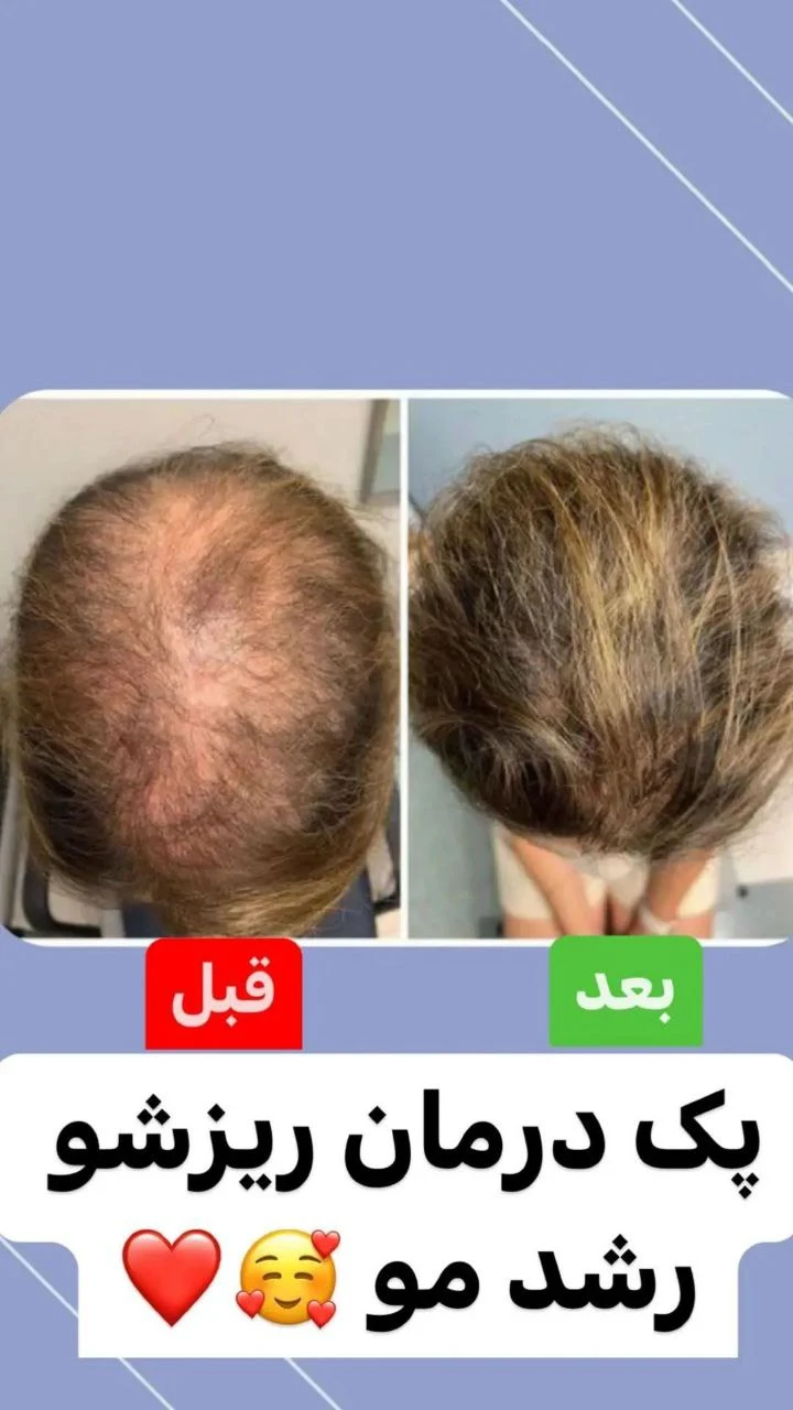آکادمی تخصصی ترمیم مو و پوست ابراهیمی - لوازم بهداشتی و شوینده در تهران - تصویر 2