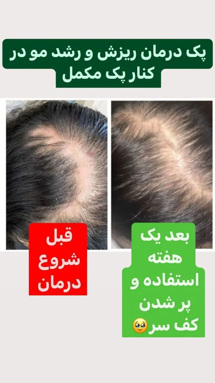آکادمی تخصصی ترمیم مو و پوست ابراهیمی - لوازم بهداشتی و شوینده در تهران - تصویر 3