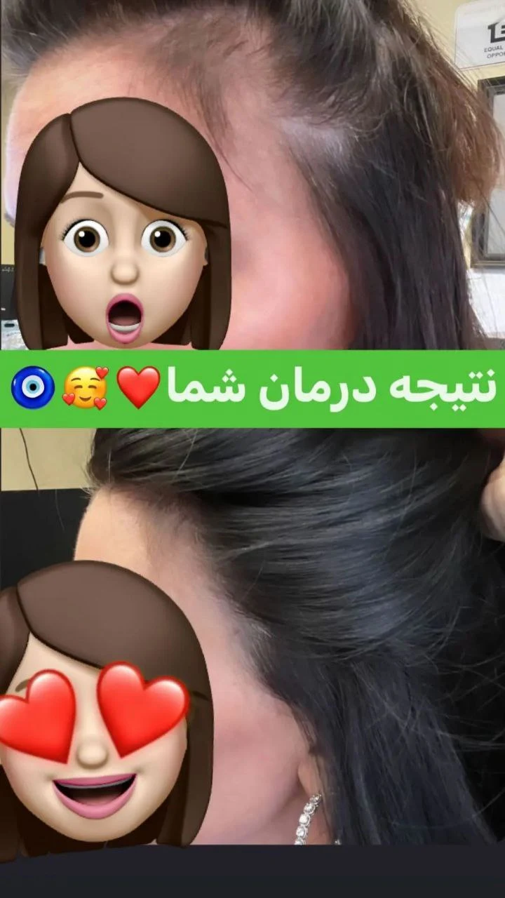 آکادمی تخصصی ترمیم مو و پوست ابراهیمی - لوازم بهداشتی و شوینده در تهران - تصویر 4