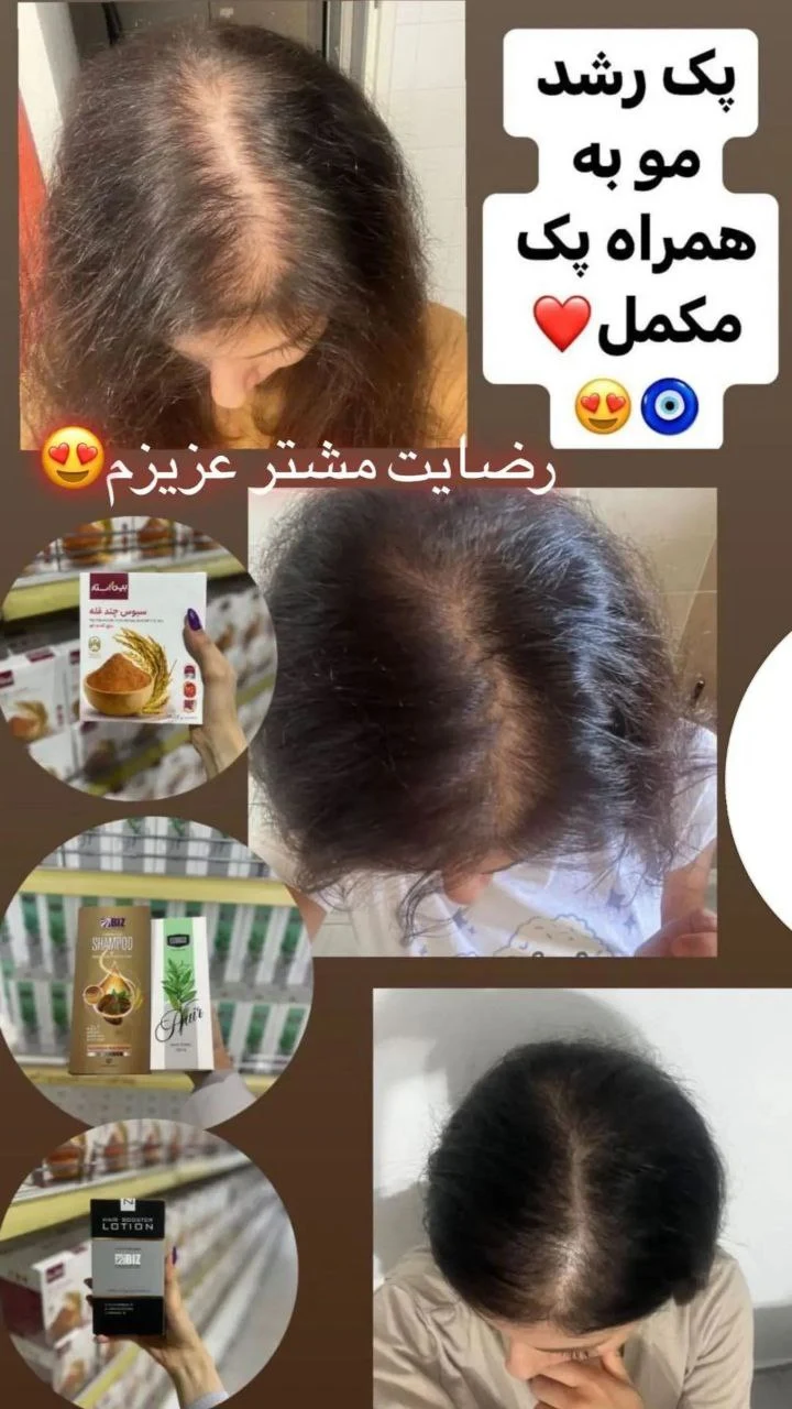 آکادمی تخصصی ترمیم مو و پوست ابراهیمی - لوازم بهداشتی و شوینده در تهران - تصویر 5