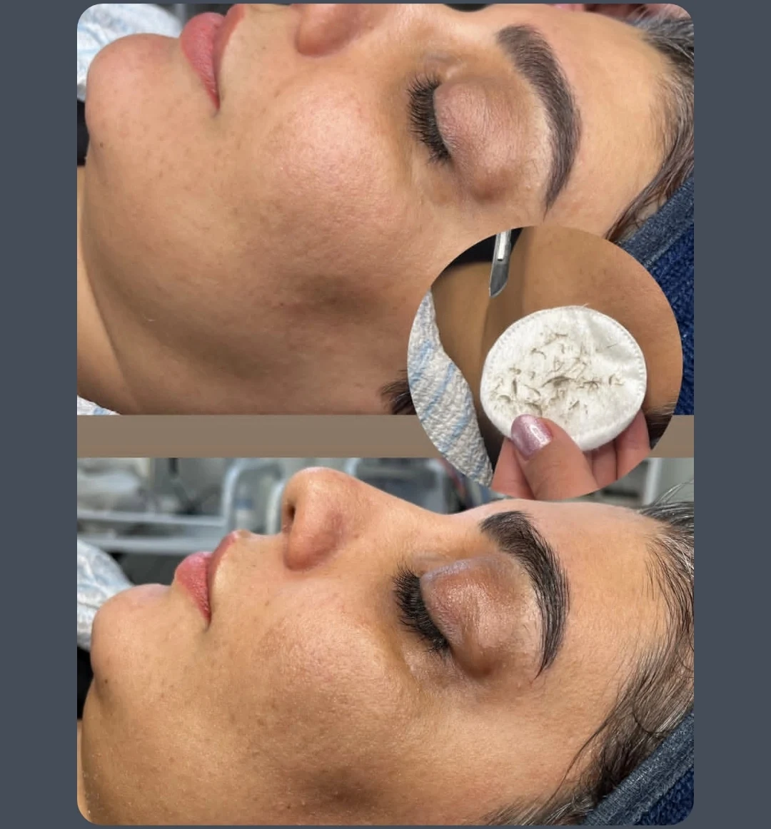 فیشیال و پاکسازی پوست طهرانی در مطب پزشک