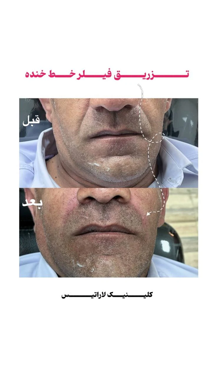 کلینیک زیبایی لاراتیس دکتر علی محدث - تصویر 2