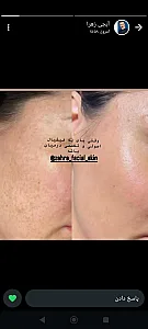 خدمات زیبایی سیده زهرا میرحسینی
