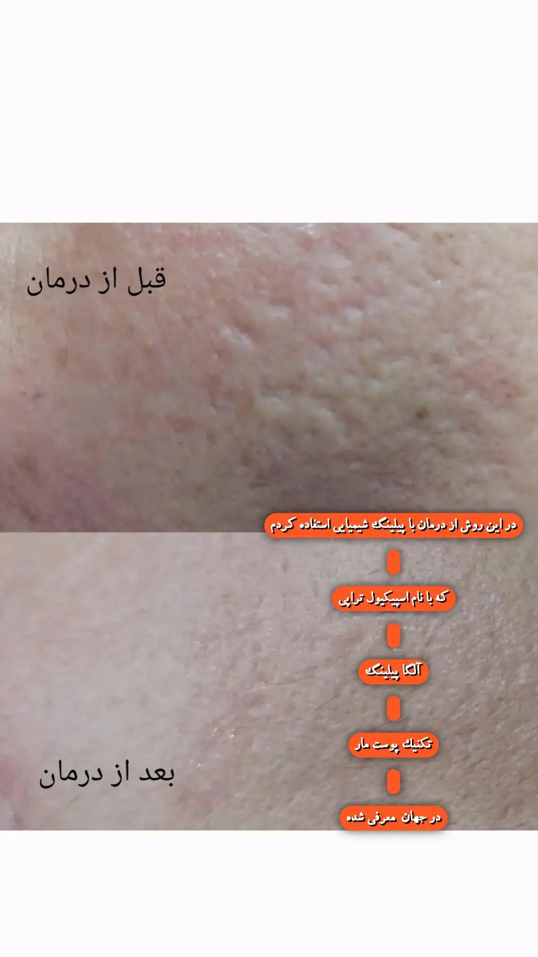 فیشال و درمان لک و اسکارو جوش - تصویر 3