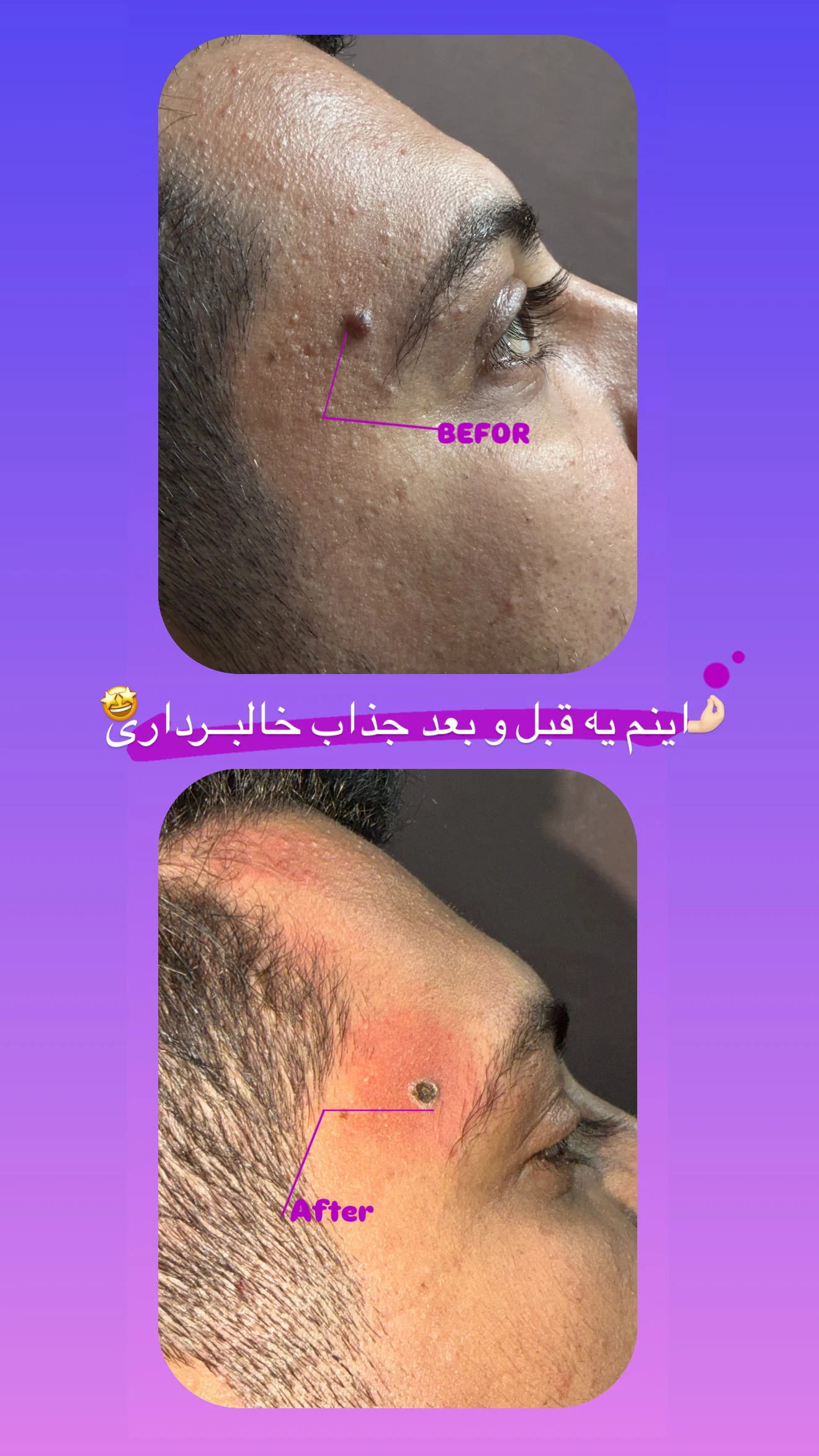 کلینیک لیزر پوست و مو پرستو محمدی - کلینیک پوست و زیبایی در شهرکرد - تصویر 3