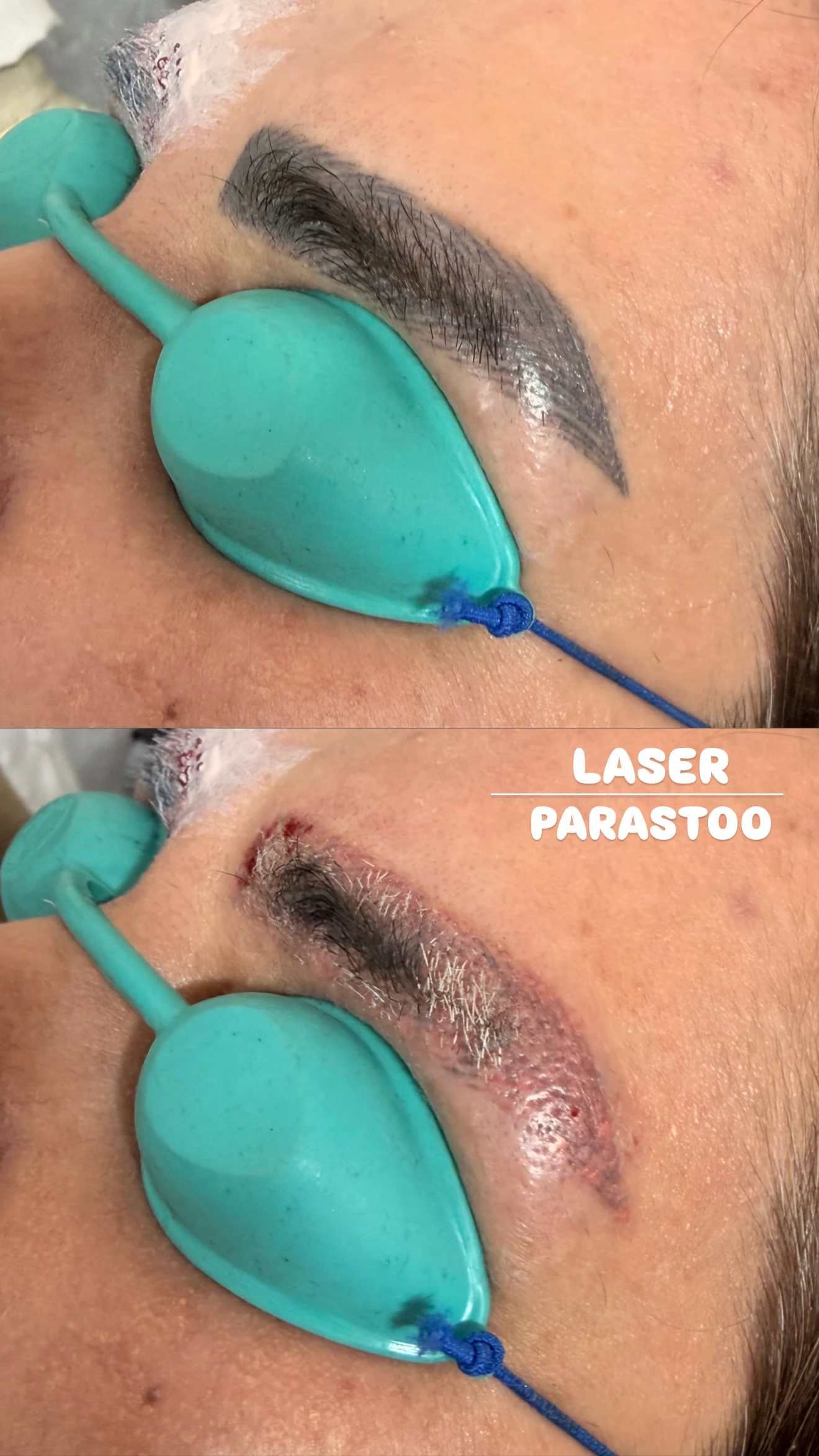 کلینیک لیزر پوست و مو پرستو محمدی - کلینیک پوست و زیبایی در شهرکرد - تصویر 4