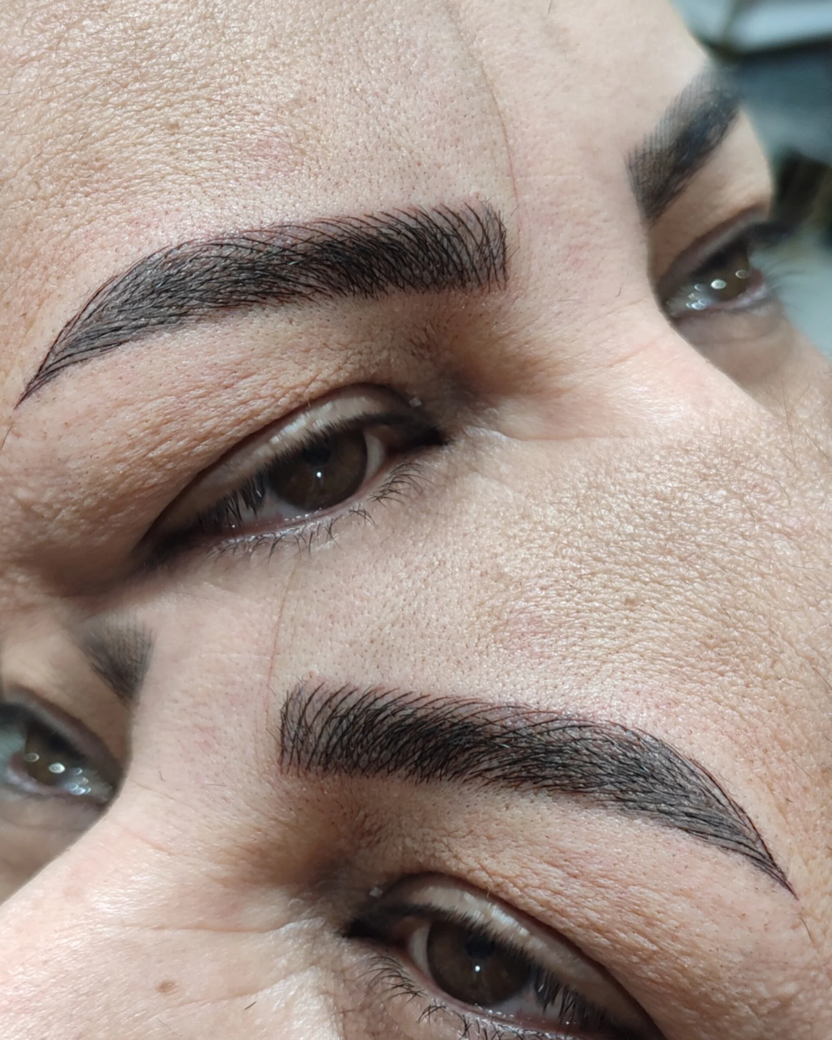 میکروبلیدینگ و میکروپیگمنتیشن - تصویر 2