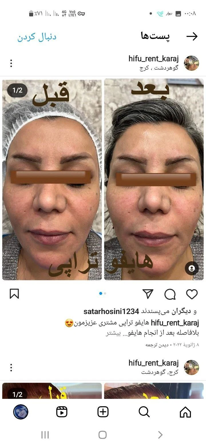 Haifu kermanshah کلینیک زیبایی