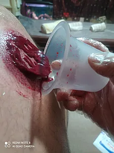 مرکز  حجامت وطب سنتی ابن سینا