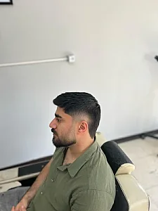 پیرایش هیرکات