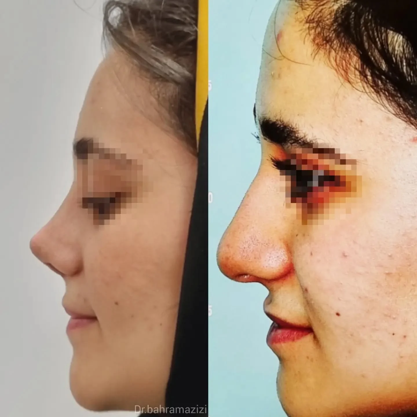 دکتربهرام عزیزی