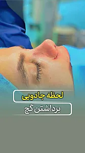 دکتر عارفه هدایتی جراح بینی