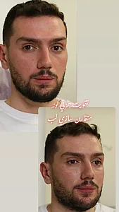 کلینیک زیبایی پوست و لیزر آلن