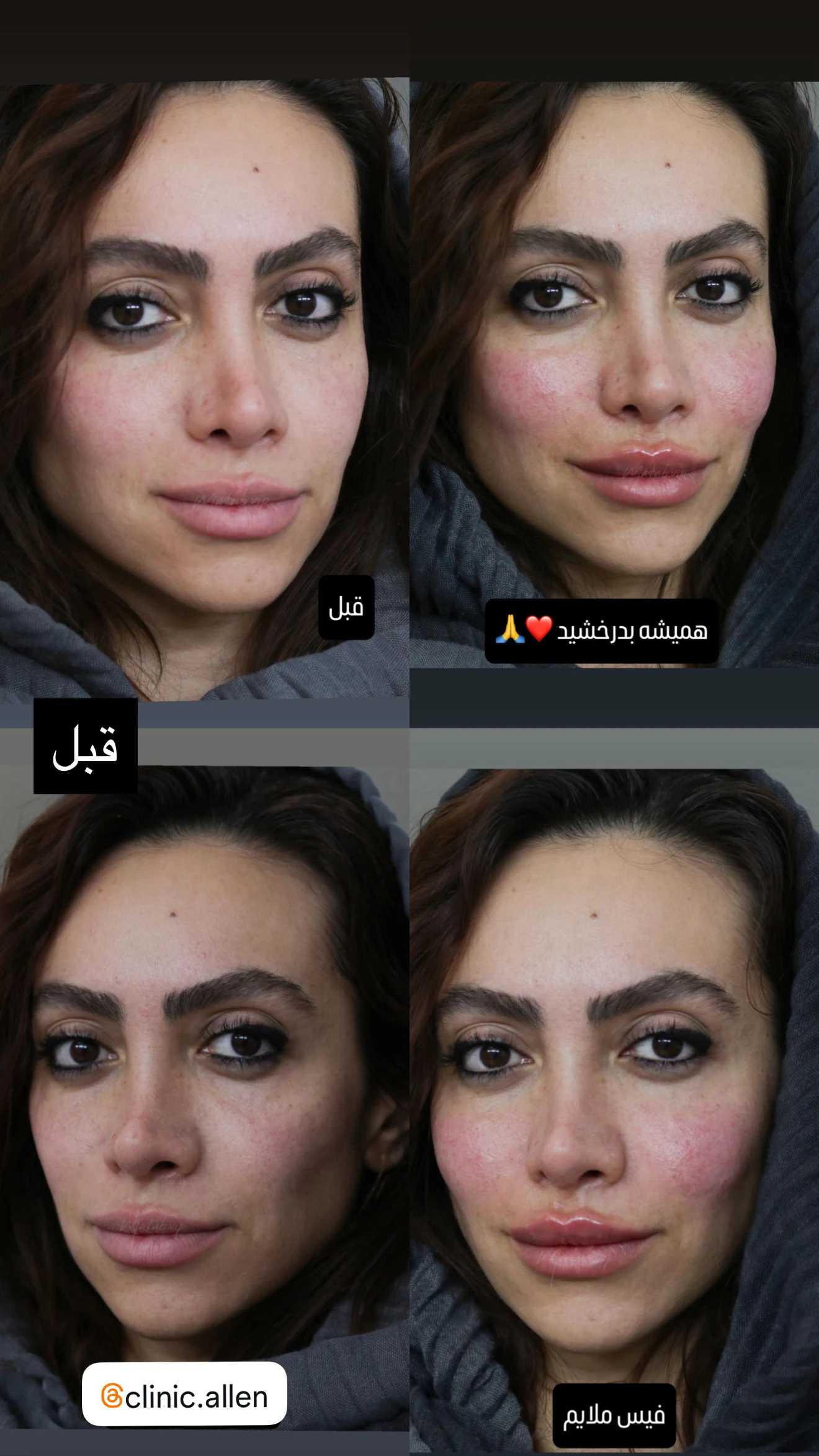 کلینیک زیبایی پوست و لیزر آلن - تصویر 2