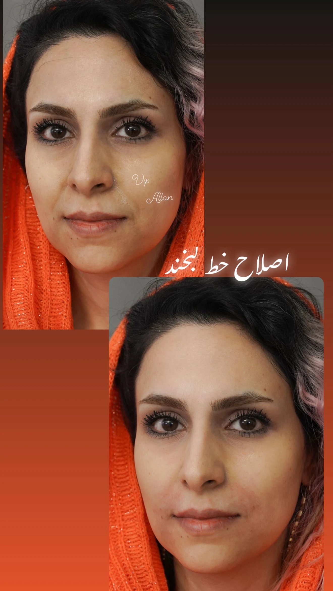 کلینیک زیبایی پوست و لیزر آلن - تصویر 3