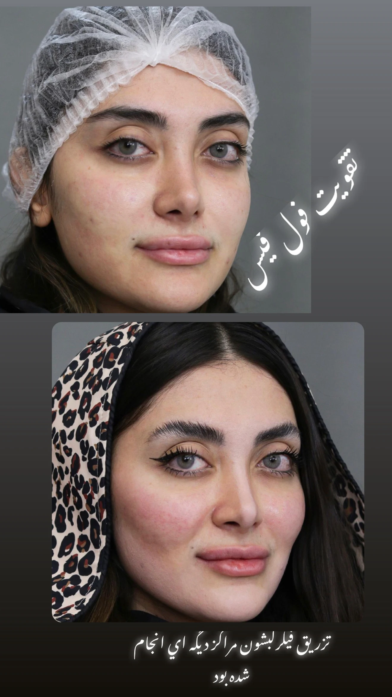 کلینیک زیبایی پوست و لیزر آلن - تصویر 5