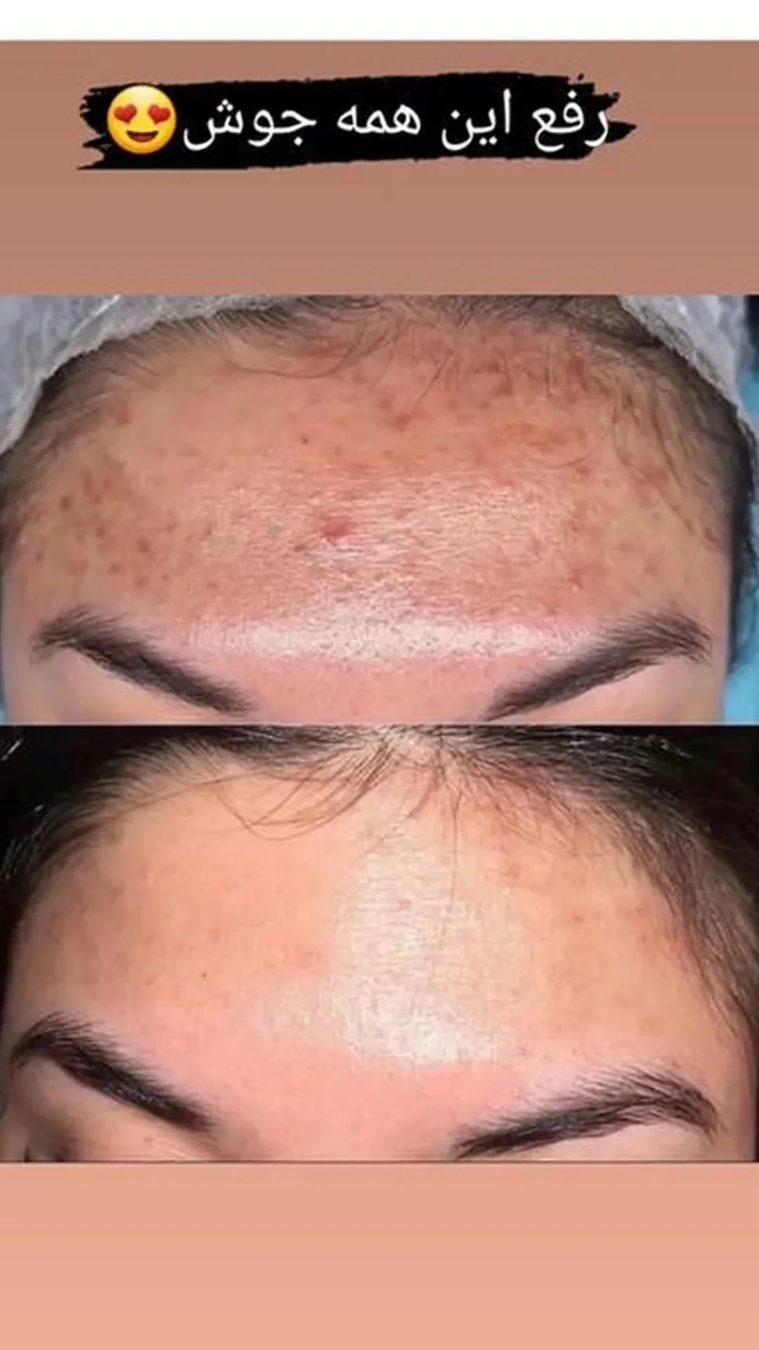 فیشال پوستshirinzendehbodi.skincare - تصویر 2
