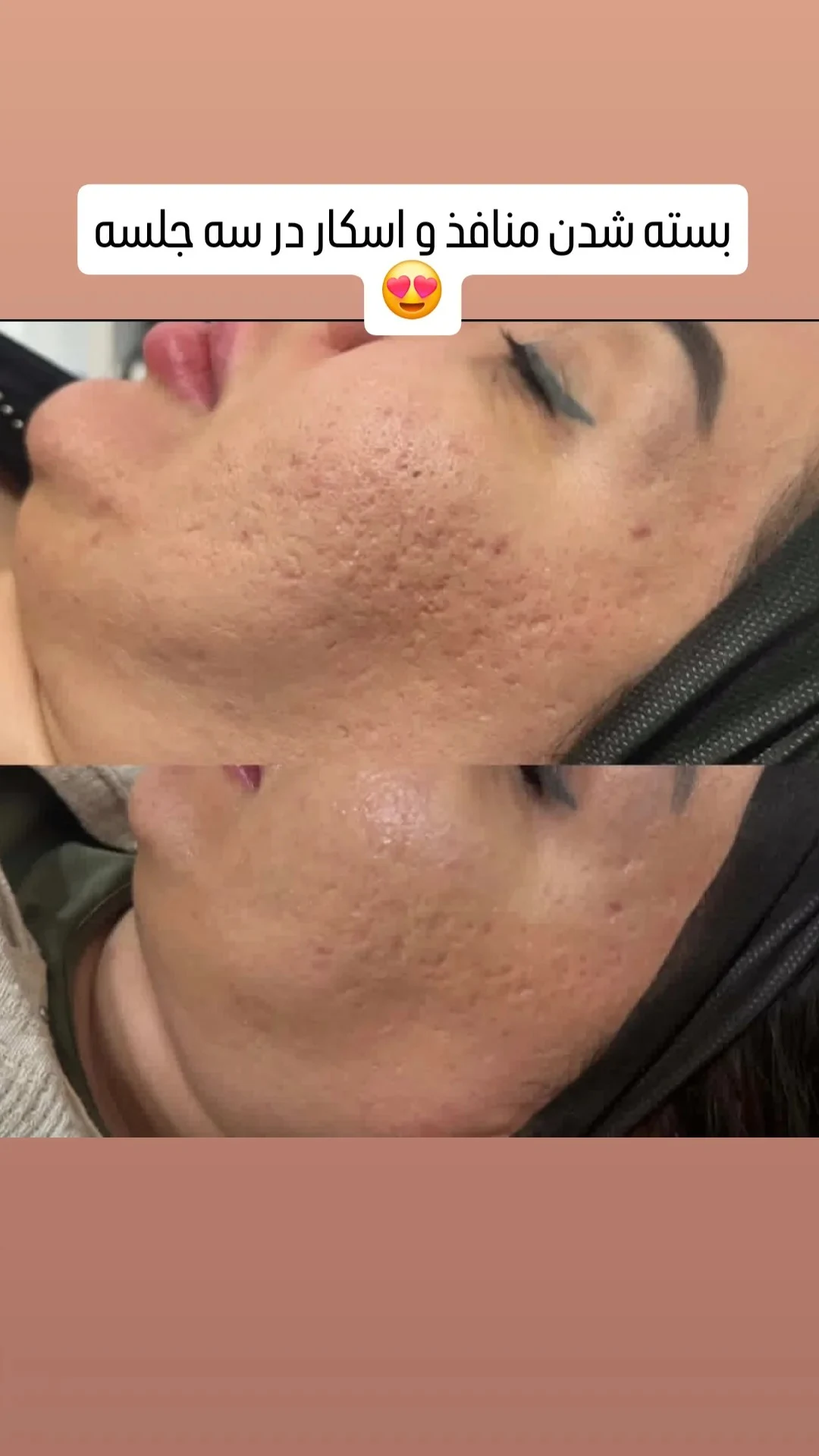فیشال پوستshirinzendehbodi.skincare - تصویر 3