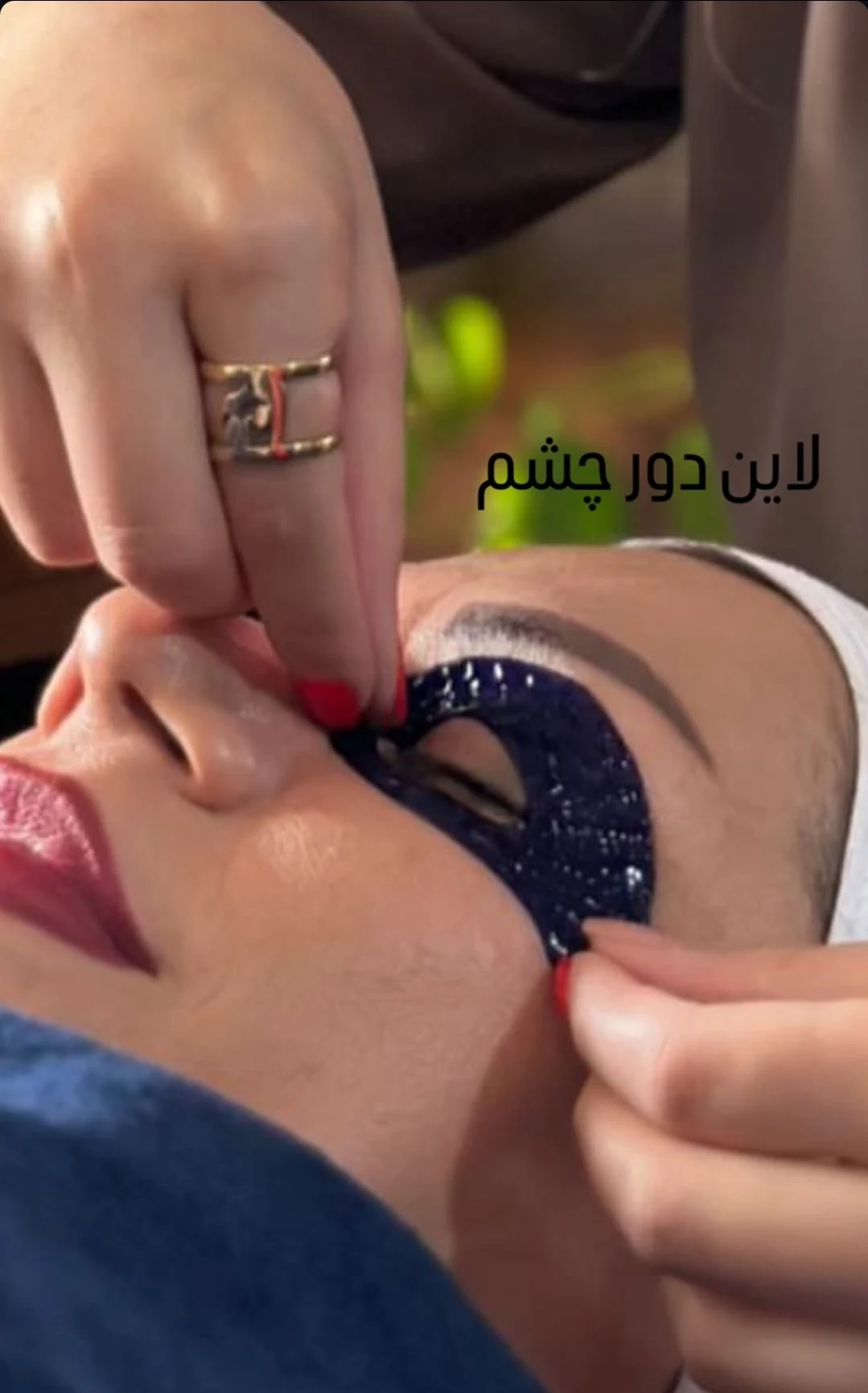 فیشال پوستshirinzendehbodi.skincare - تصویر 5