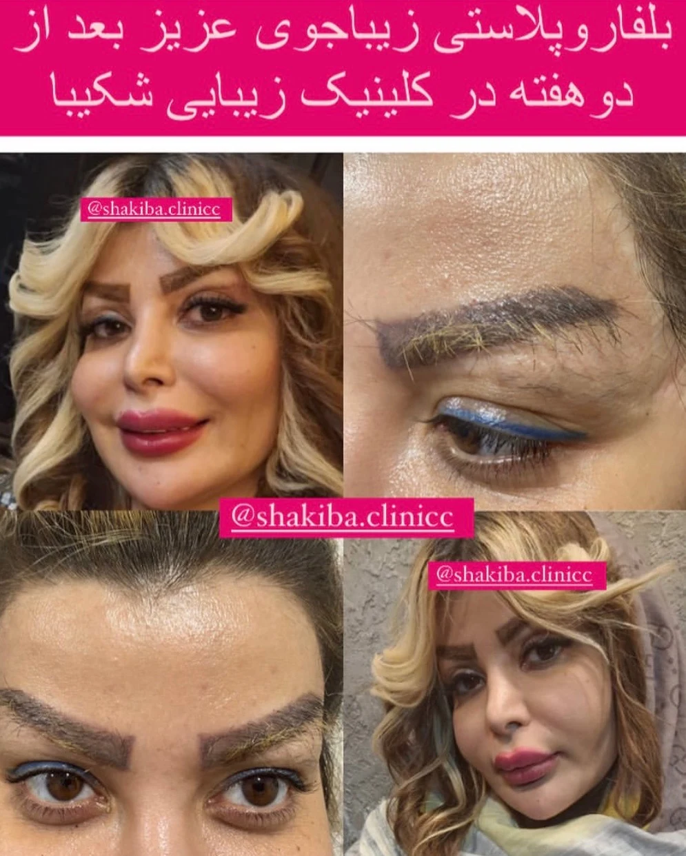 کلینیک زیبایی پوست نیایش