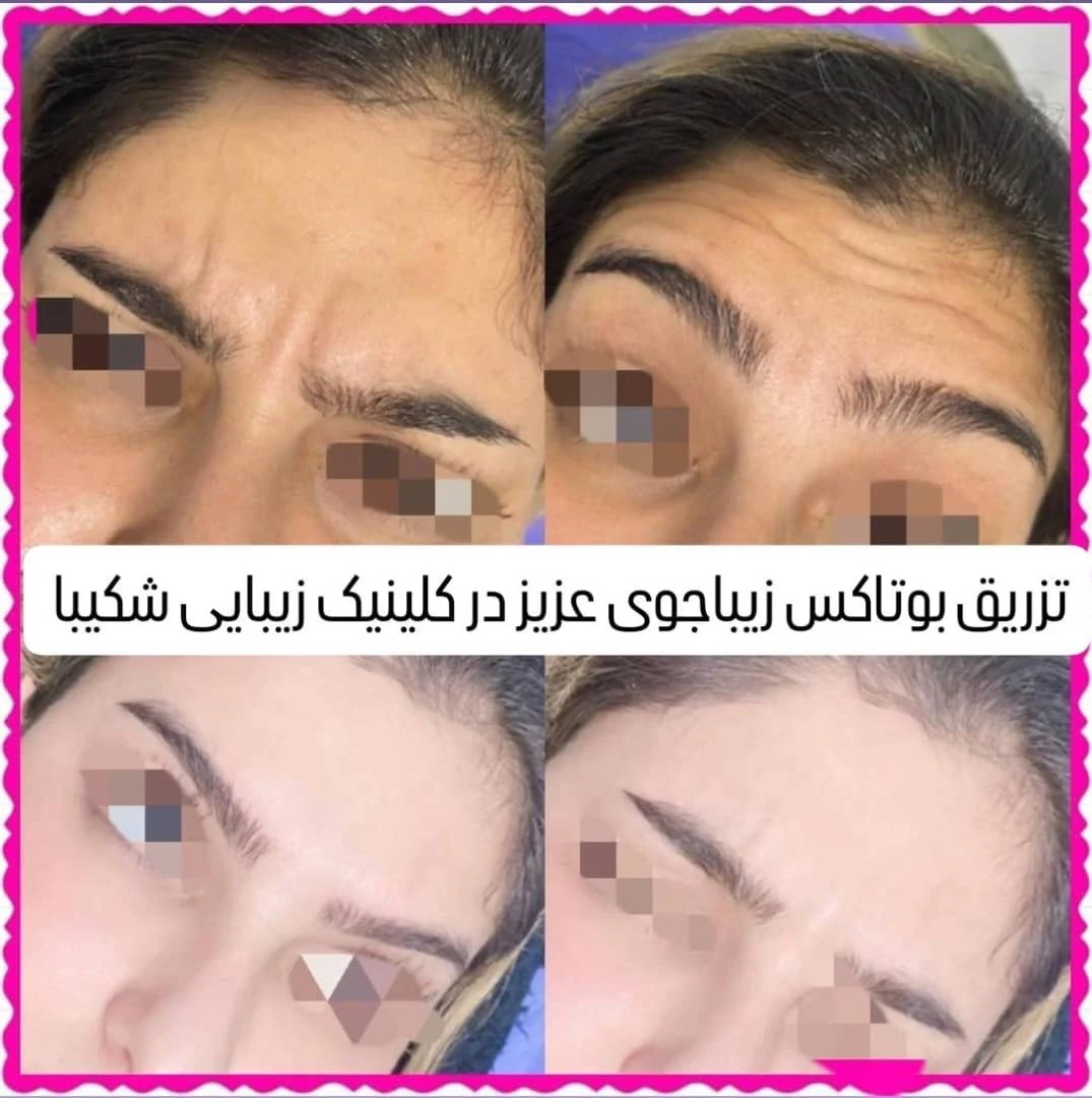 کلینیک زیبایی پوست نیایش - تصویر 2