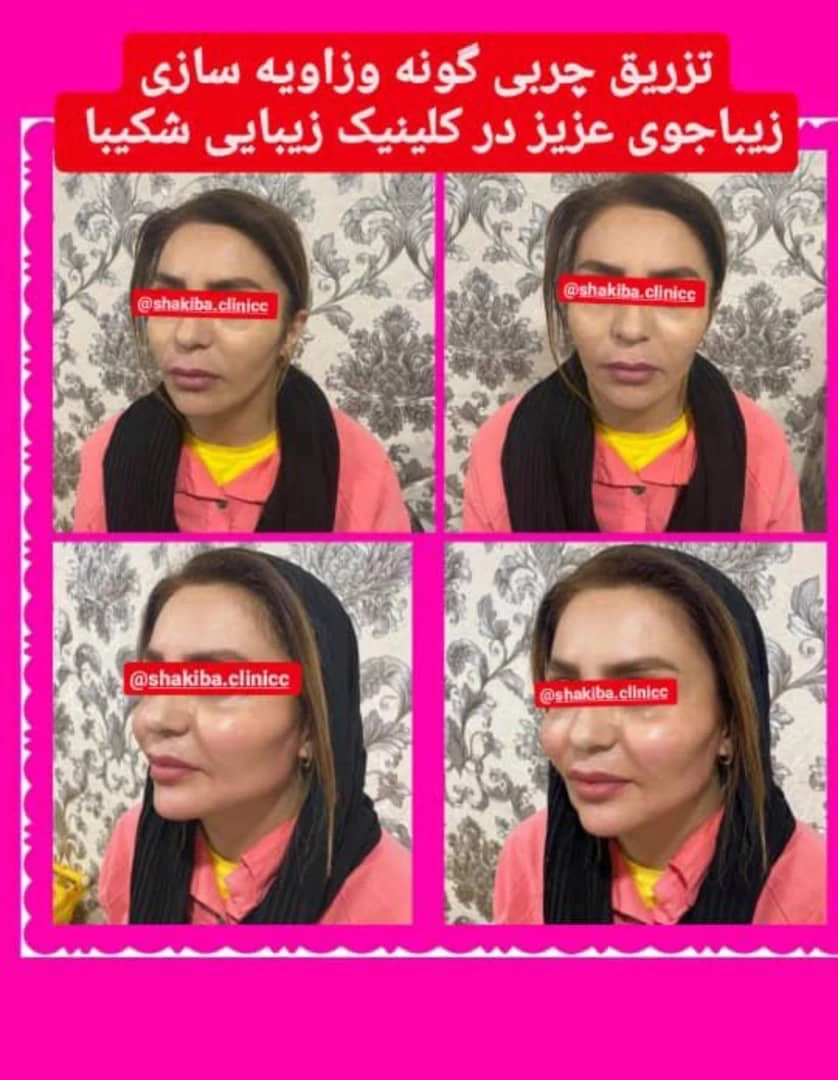 کلینیک زیبایی پوست نیایش - تصویر 3