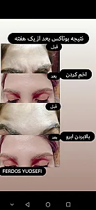 آیروس بیوتی