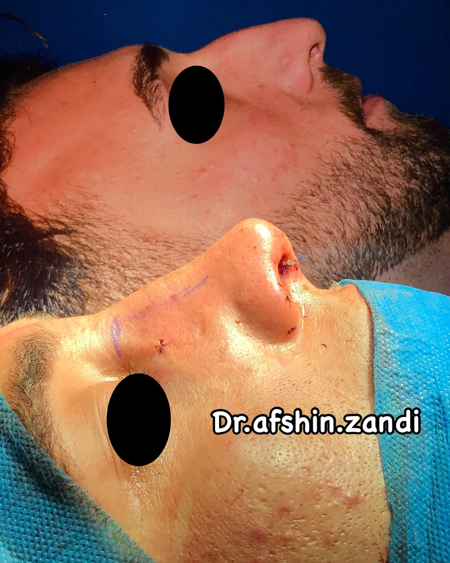 دکتر افشین زندی