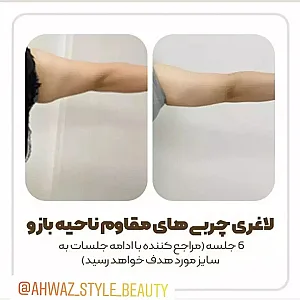 کلینی لاغری اهواز استایل