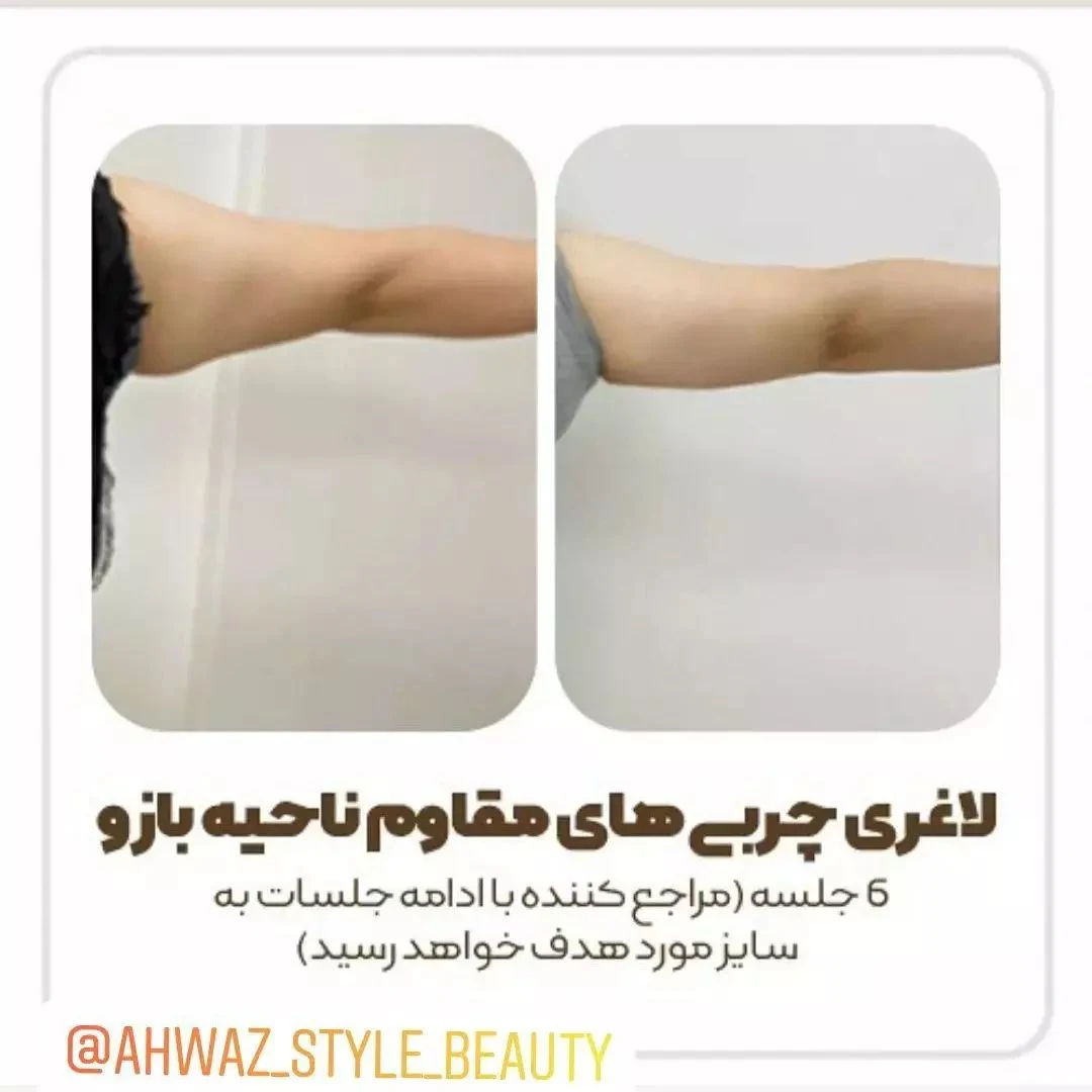 کلینی لاغری اهواز استایل