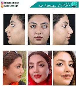 دکتر فرزاد فیروزی
