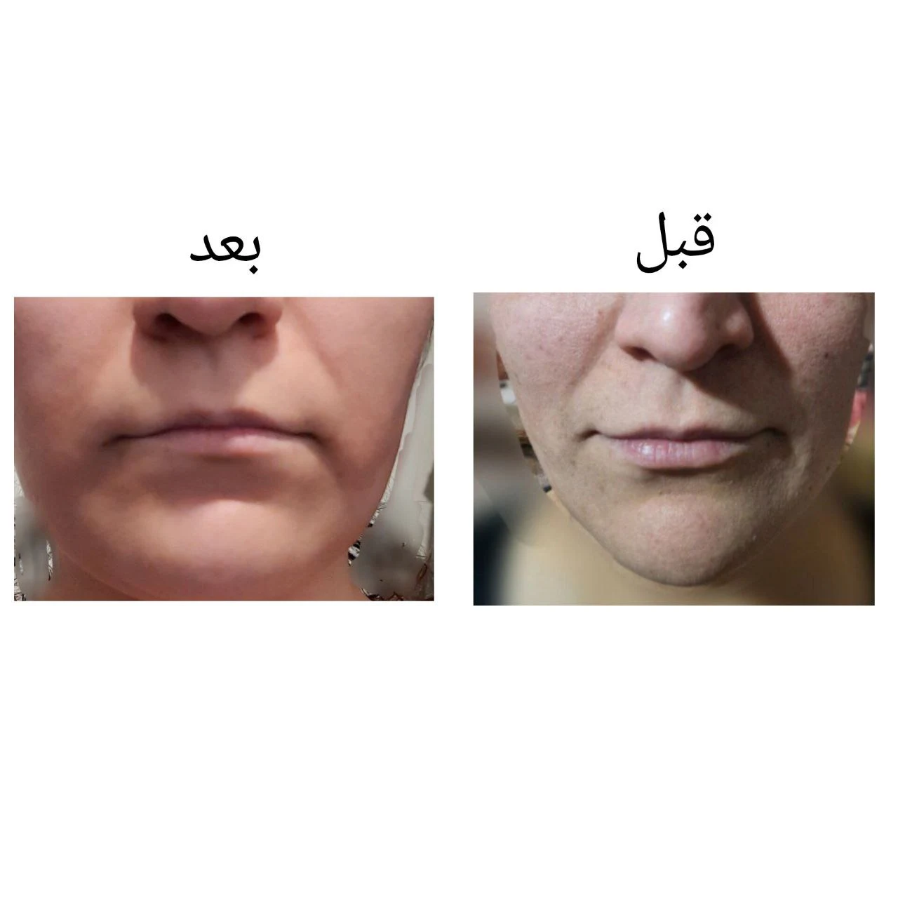 مراقبت زیبایی عادلی