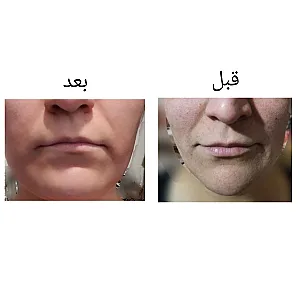 مراقبت زیبایی عادلی
