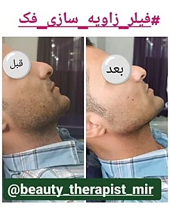 کیلینک آپادانا