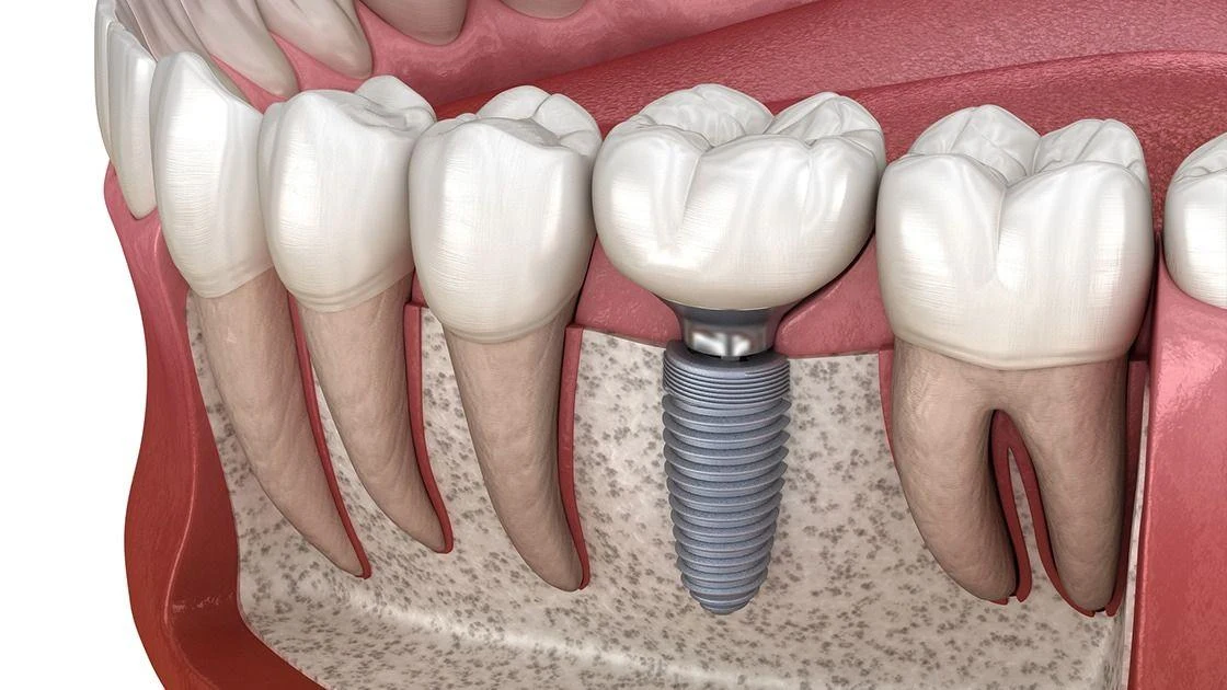 دکتر هادی زارع متخصص دندانپزشکی