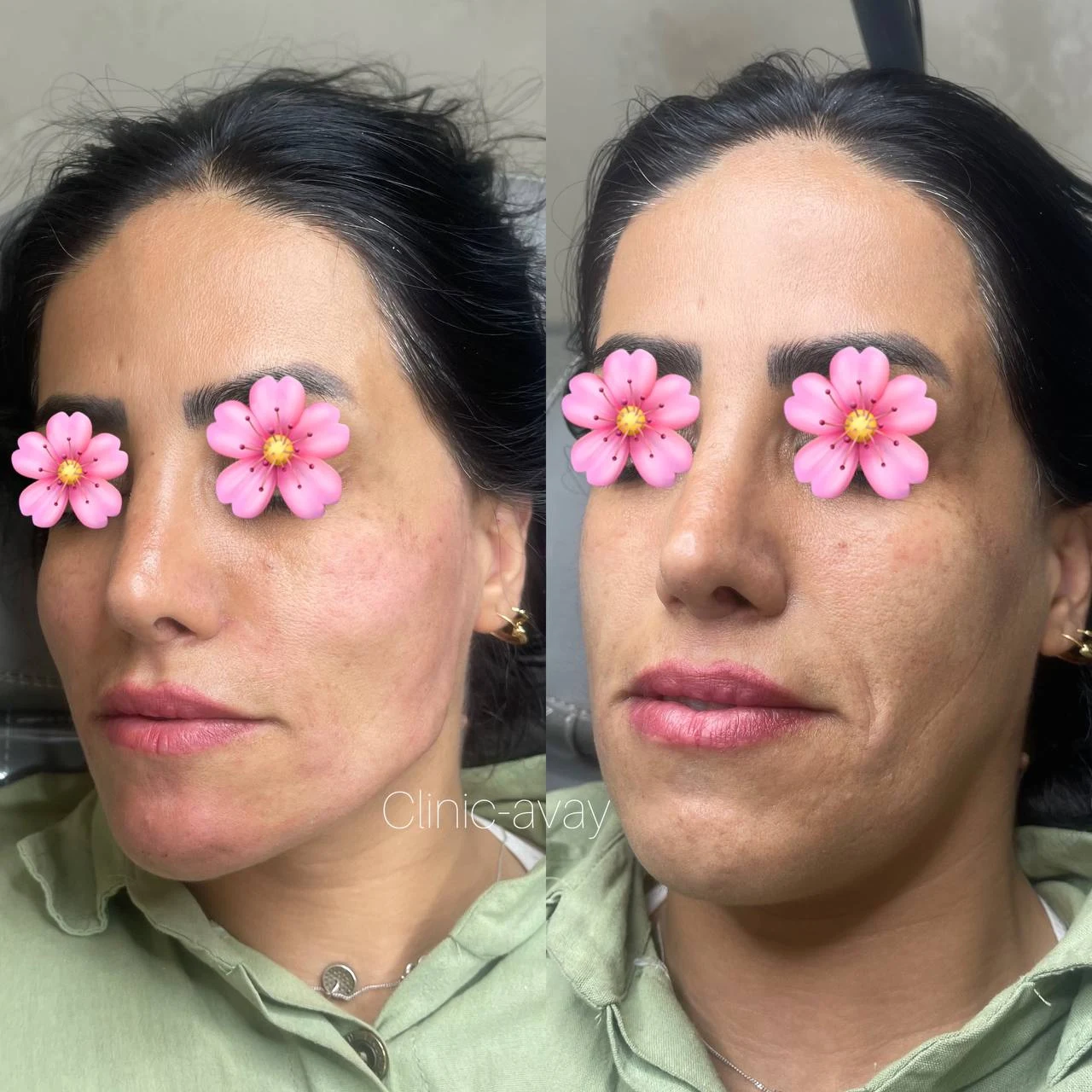 کلینیک زیبایی آوا