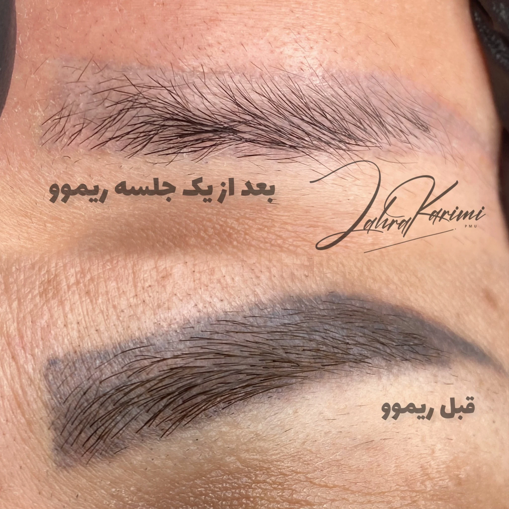 مرکز ارایش دائم و ریموو گرگان - تصویر 4