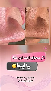 مرکز پاکسازی پوست نازنین کیخانی