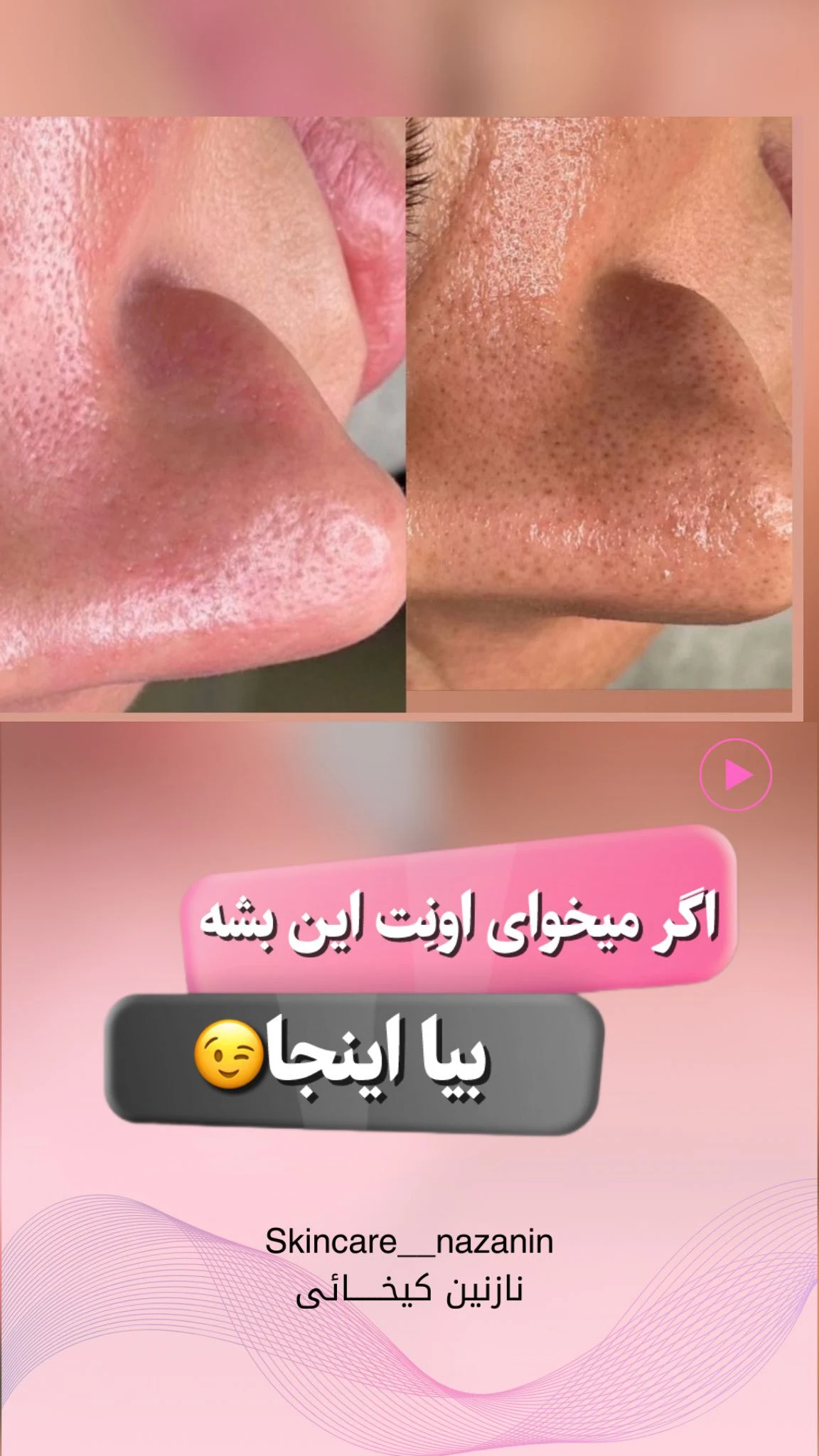 مرکز پاکسازی پوست نازنین کیخانی