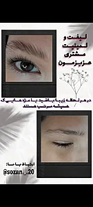 خدمات لیفت لمینت و کاشت مژه سوزان
