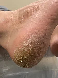 مستر پدیکور گرگان